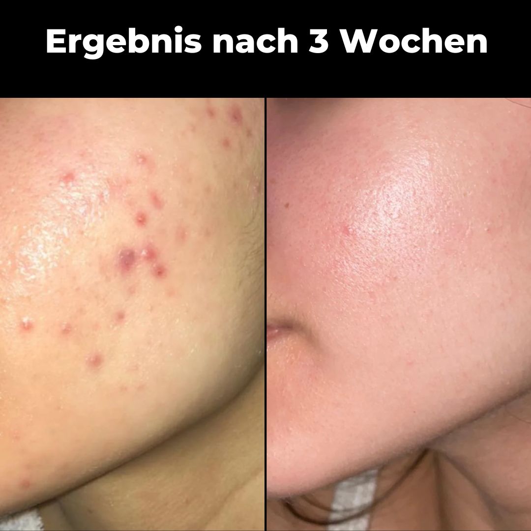 Lunessa Seidenkissenbezug